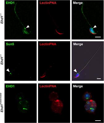 A missense mutation in Ehd1 associated with defective spermatogenesis and male infertility